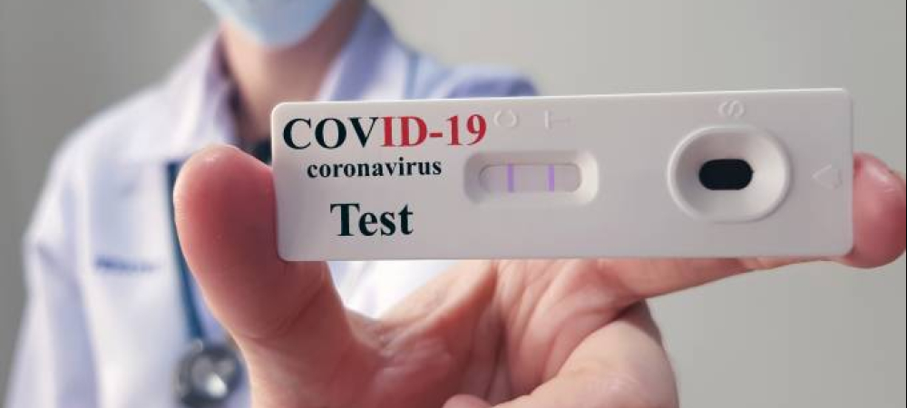Sindilojas Caxias oferece testes rápidos de Covid-19 para o comércio   