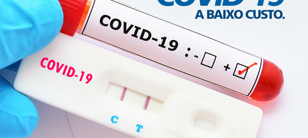 Sindilojas Caxias disponibiliza novo lote de testes rápidos de Covid-19 para o comércio     